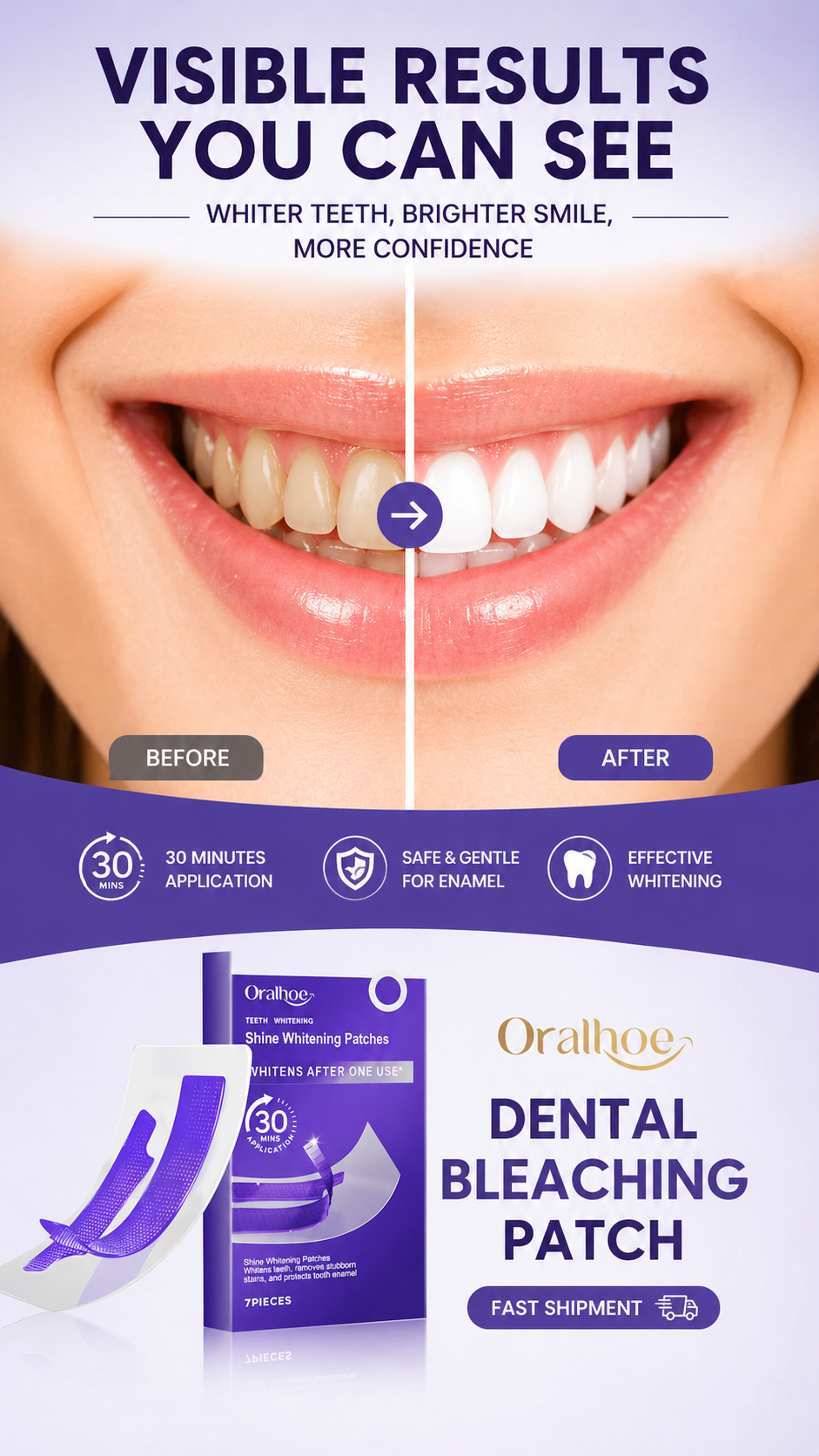 Oralhug dental bleaching patch packaging with before and after smile display on a purple background.