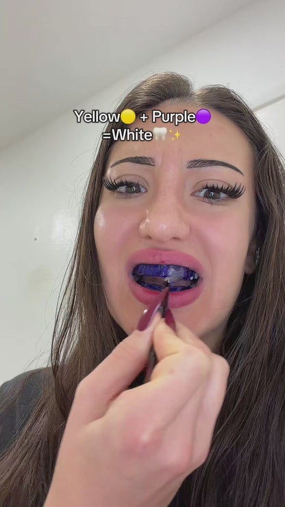 SmilePro Teeth Whitening Strips